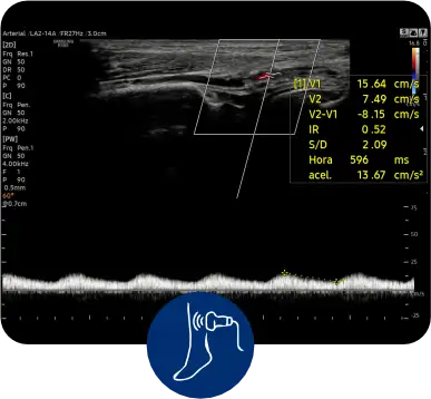 Doppler Vascular