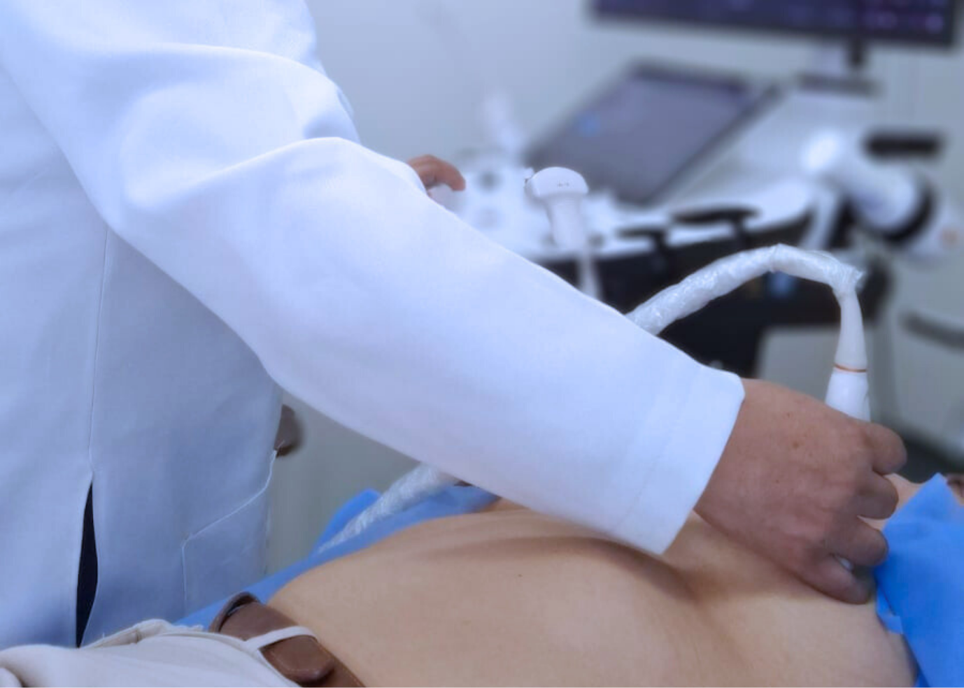 ECOGRAFÍA DE SEGUNDA OPINIÓN